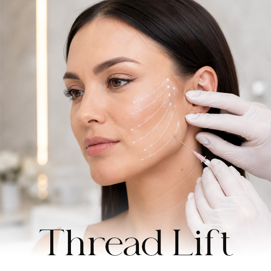Thread Lift